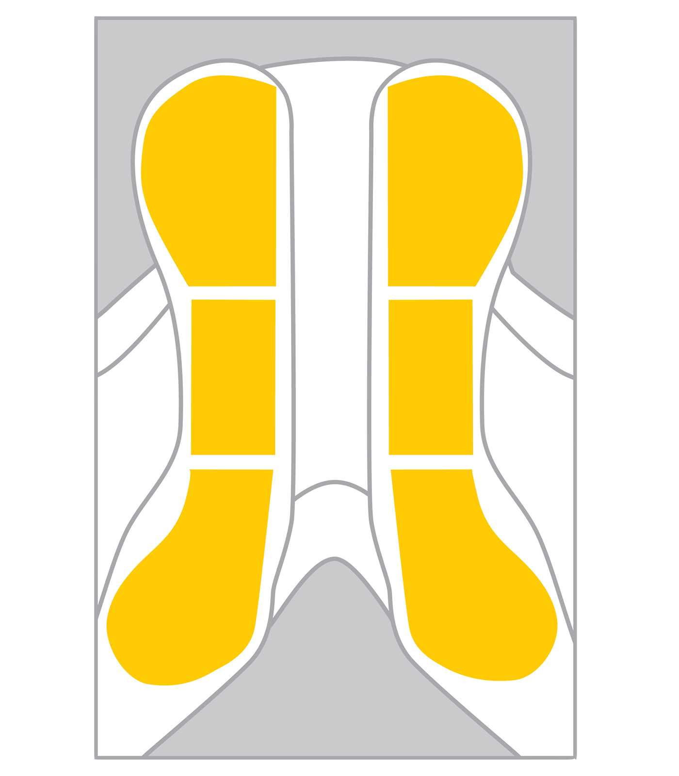Wintec EASY-CHANGE Riser System Pony Pack